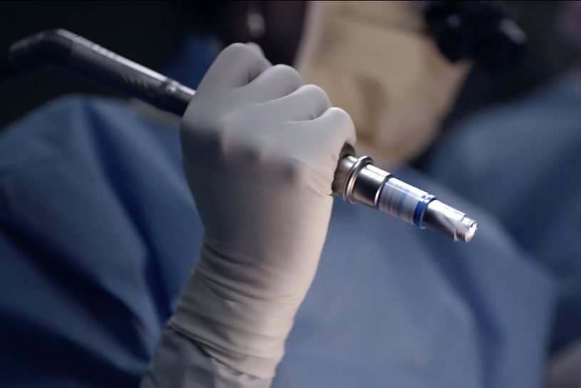 Meet a man who actually wants holes drilled into his skull